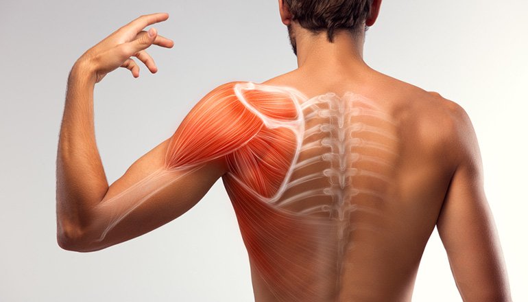 Omuz Hastalıkları omuz hastalıkları